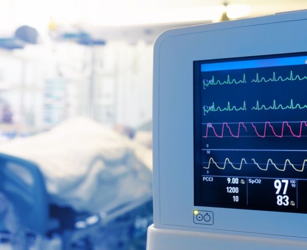 Image of a heart monitor in an ICU room